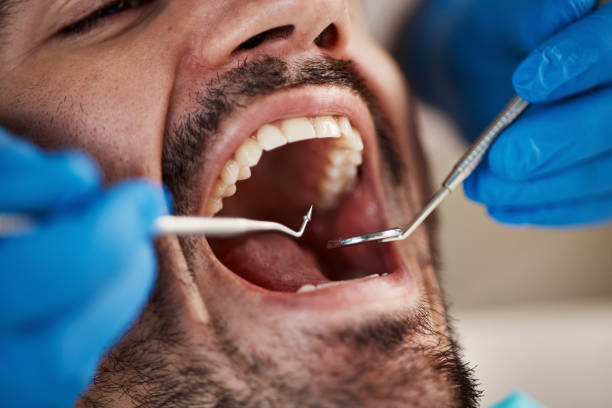 Best Emergency Dental Surgery in Balfour, NC